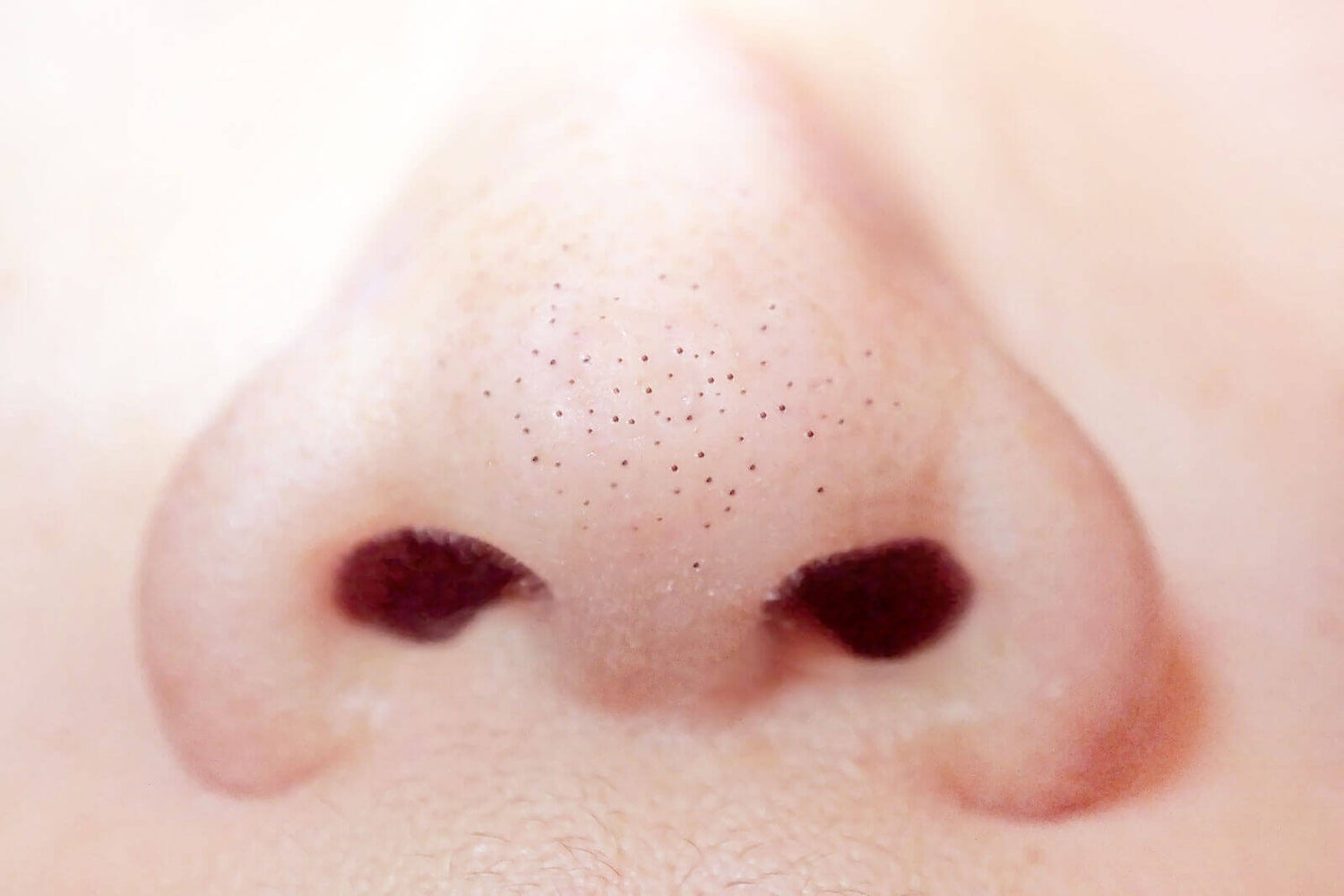 Blackheads and Enlarged Pores