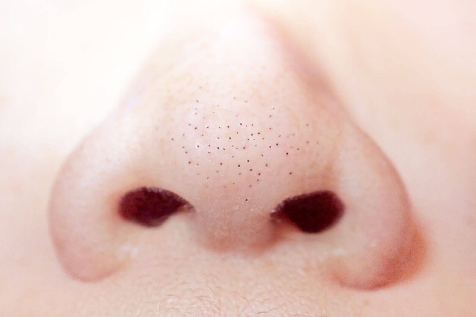 Blackheads and Enlarged Pores