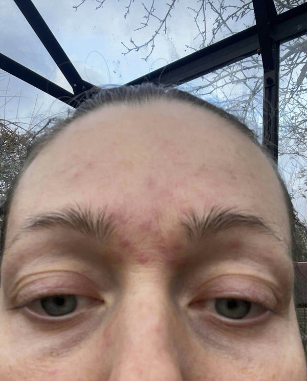 Before image for recpDtgmwJ6PSN6k4