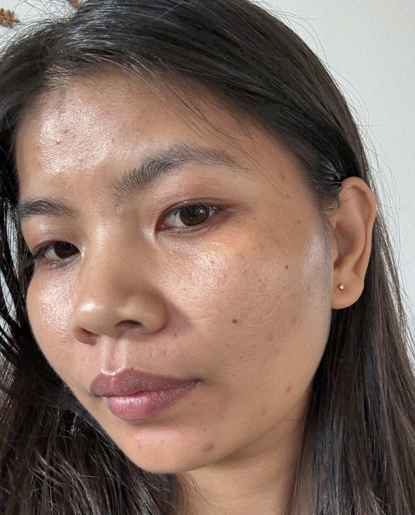 After image for recvXY6bPgI6sCSIN