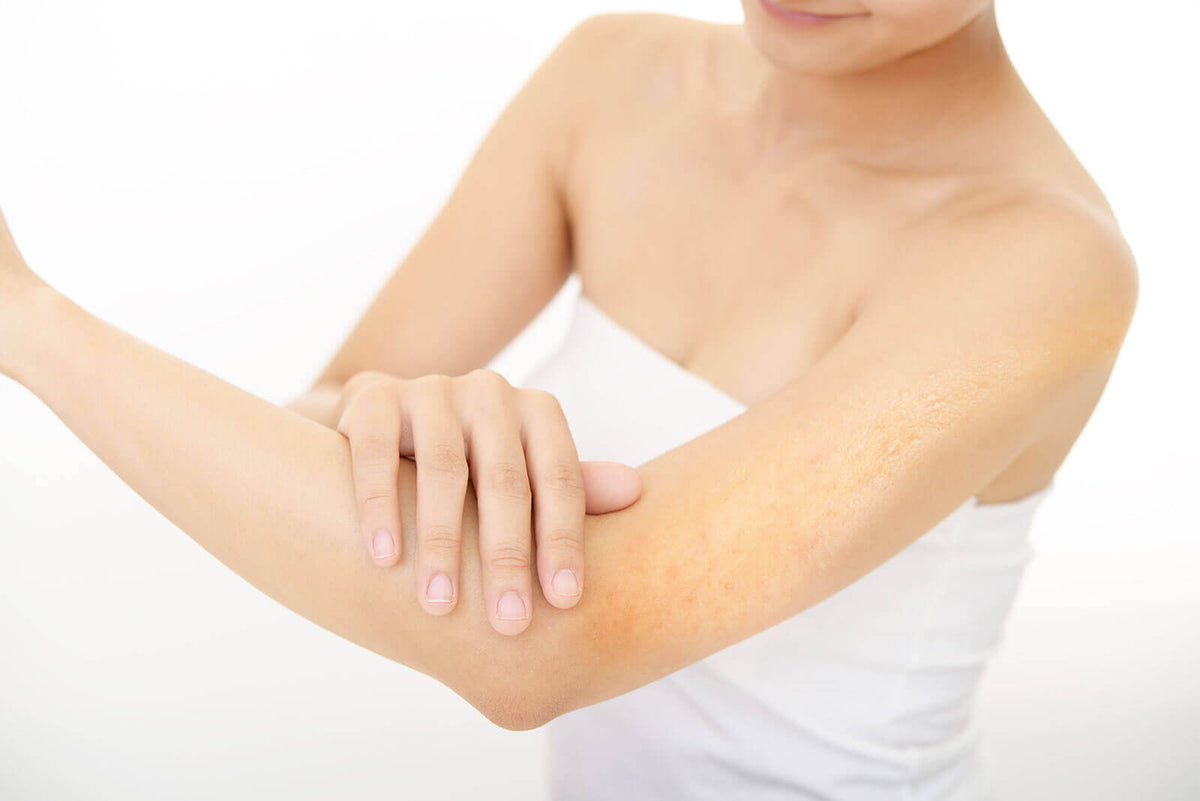 Keratosis Pilaris: Effective treatment of red buds on the arms and legs