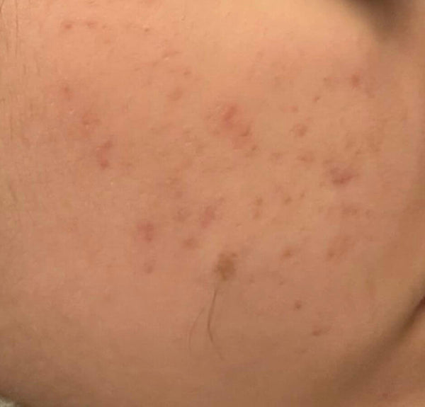 After image for rec01hxslxupPb3L3