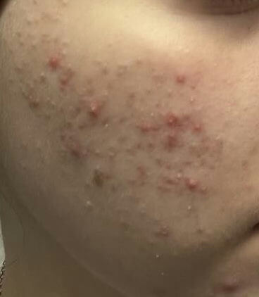 Before image for rec01hxslxupPb3L3