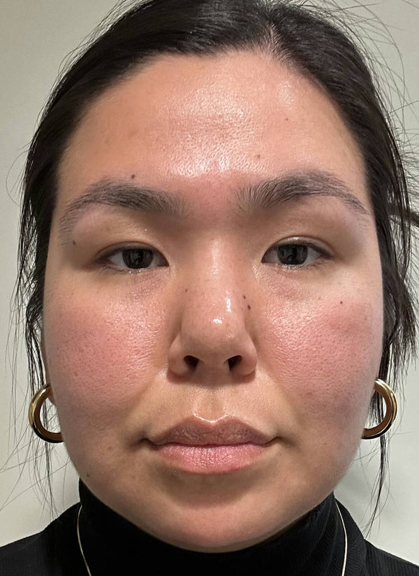 After image for rec1YM4ttfvLCoRql