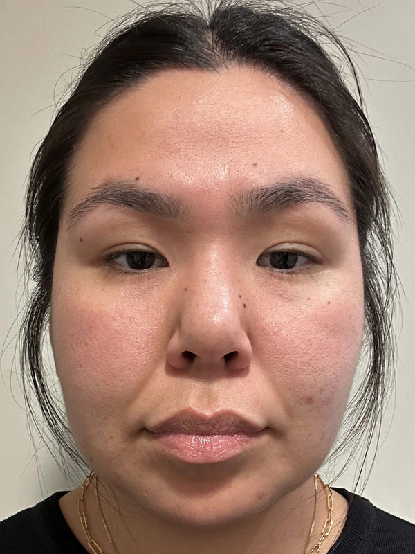 Before image for rec1YM4ttfvLCoRql