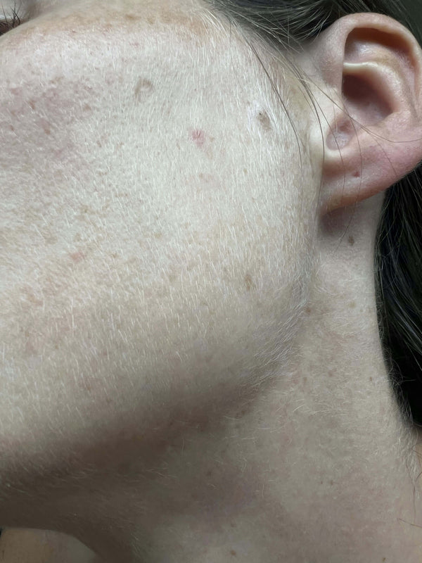 After image for rec36jkWtGbFTeNCb