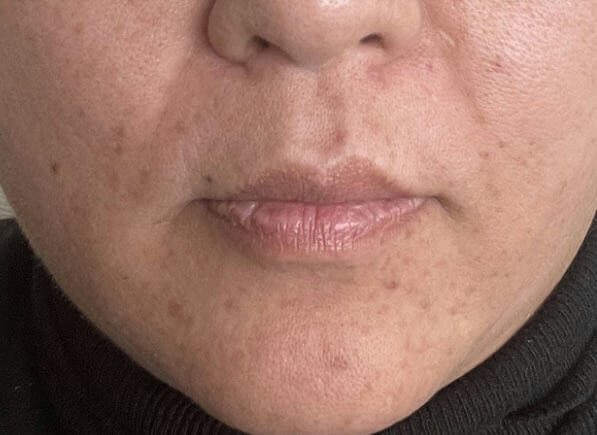 After image for rec3xqO2PZpNY8R84