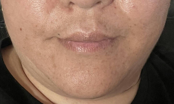 Before image for rec3xqO2PZpNY8R84