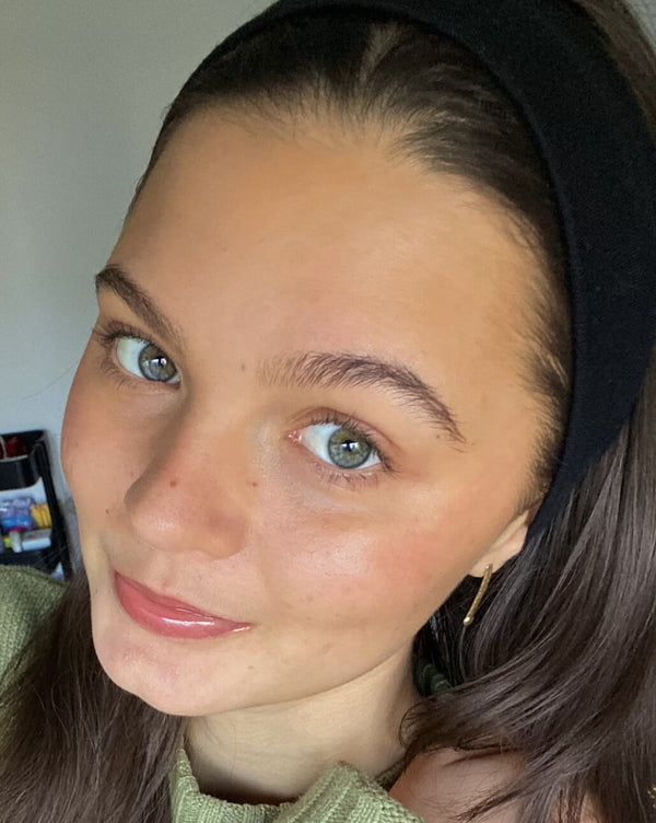 After image for rec47UNNuQdg65mjM