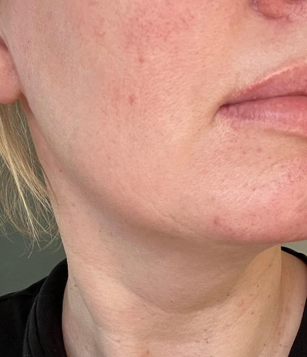 After image for rec5wLI0hki7HzAL4