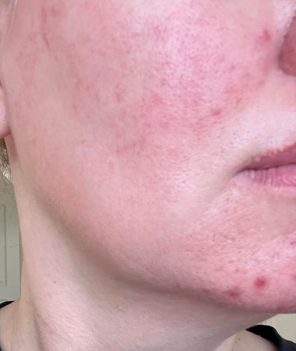 Before image for rec5wLI0hki7HzAL4