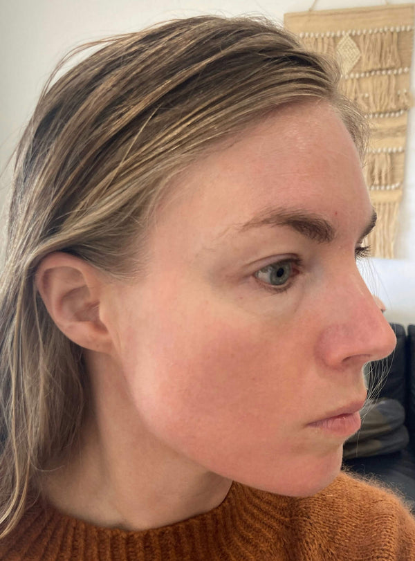 After image for rec6Z0PQOEAkEHKGq