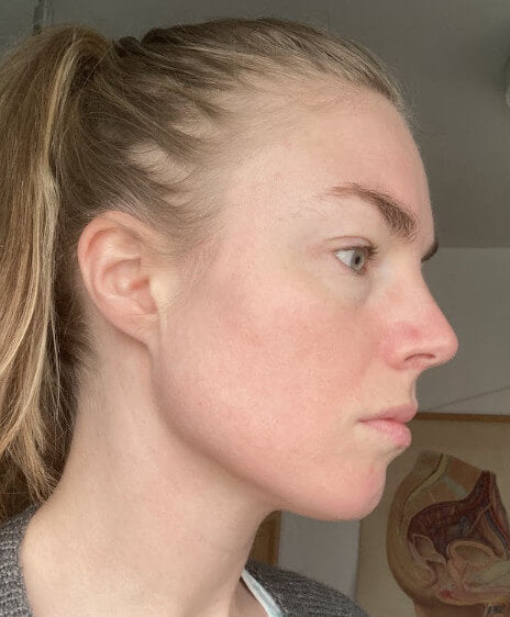 Before image for rec6Z0PQOEAkEHKGq