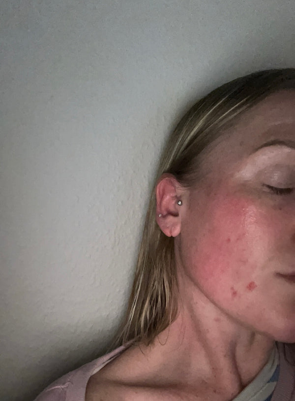 Before image for rec6ZvggoL9XtKze2