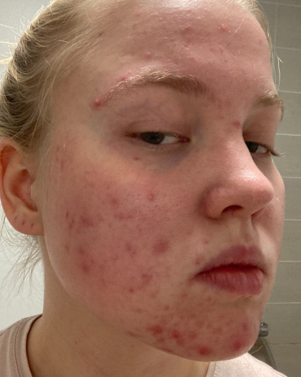 Before image for rec6n6elqrpyo8kdZ