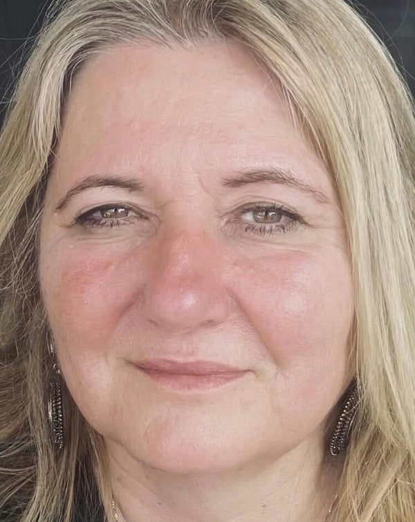 After image for rec78PohOI4cfF5WT