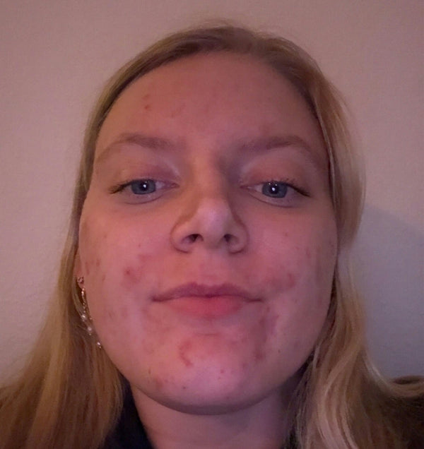After image for rec7vYd8mGfApeaBk
