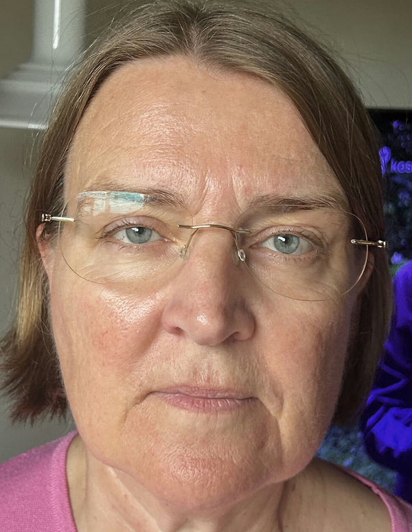 After image for rec992NR5eKbxOmA0