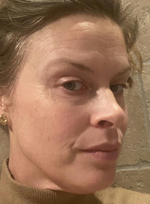 After image for rec9eTJiymwRmeiBW