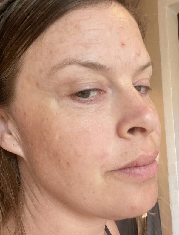 Before image for rec9eTJiymwRmeiBW