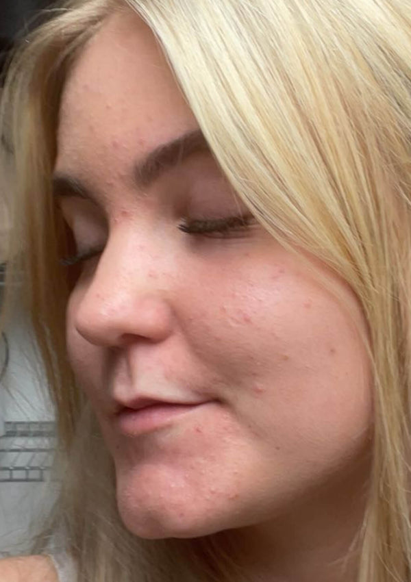 Before image for rec9g6gjBuHictmfE