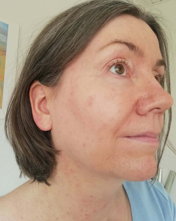 After image for recADVTYzILeqqnIn