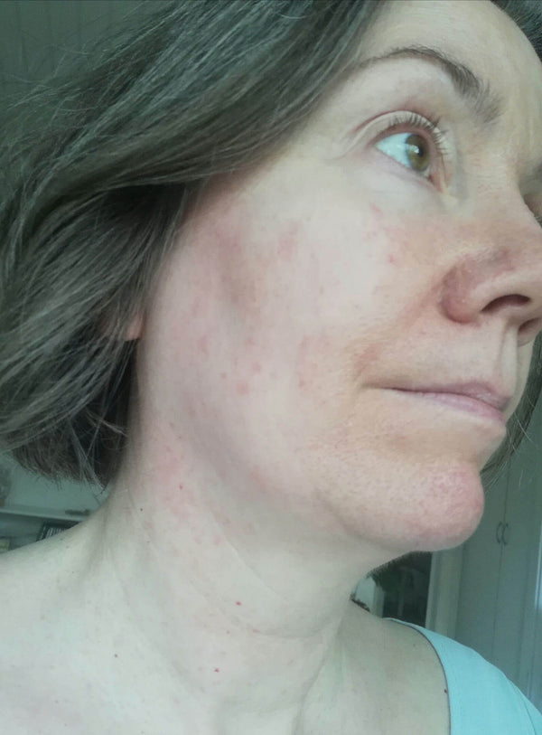 Before image for recADVTYzILeqqnIn