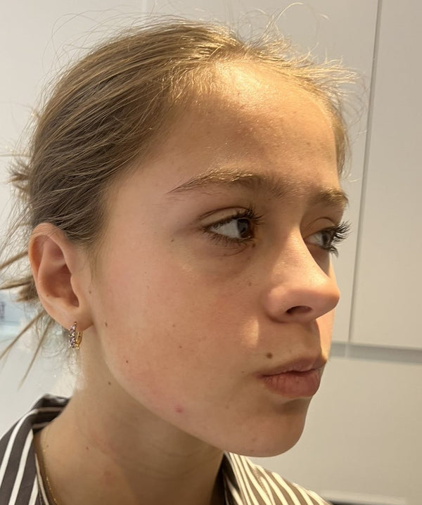 After image for recAFYkwWH44qmbAO