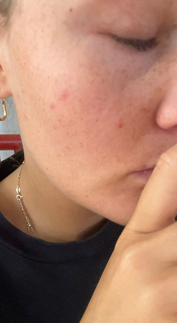 After image for recAlj7sDYdezsVum