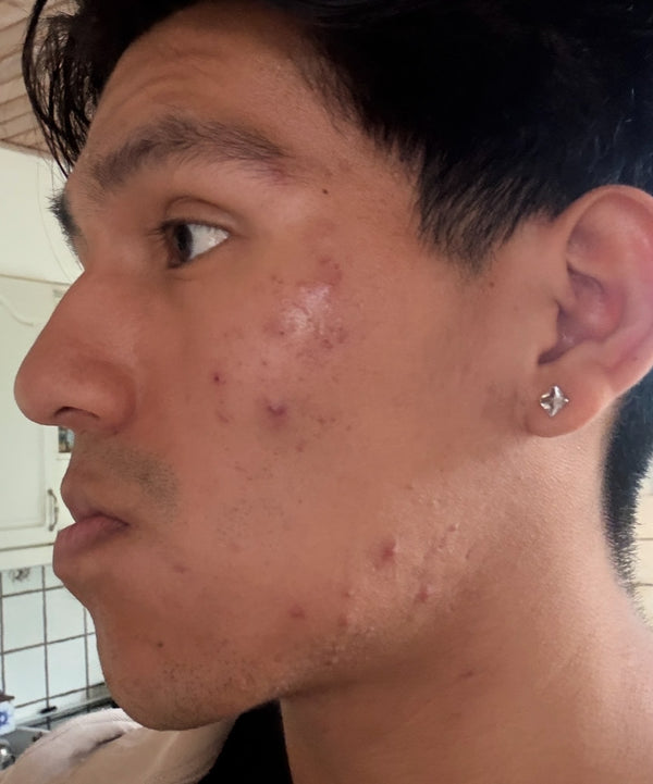 Before image for recBTh5oL3rsZESqg