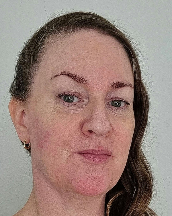 Before image for recBjsiwq2wHkgcZq