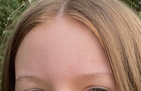 After image for recBju4g30BwIcT9v