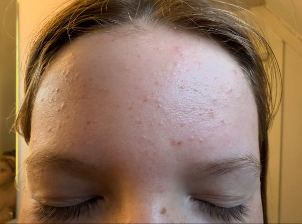 Before image for recBju4g30BwIcT9v