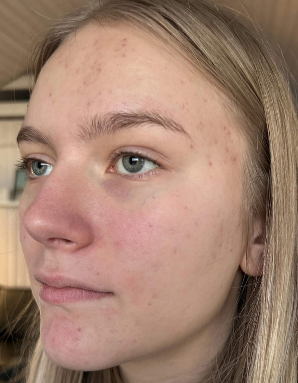 After image for recFA65PsBaWayQi3