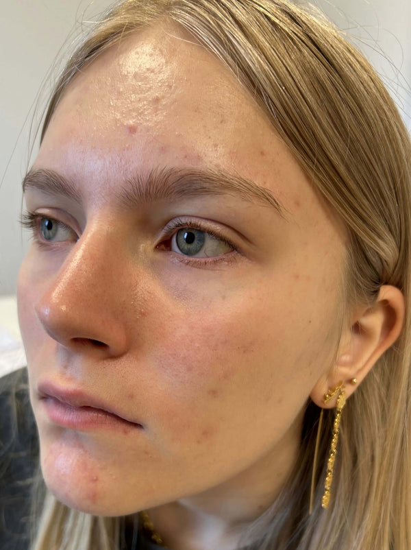 Before image for recFA65PsBaWayQi3