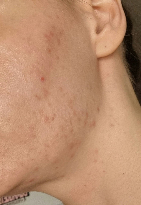 After image for recHLG7MefJIIQNHY