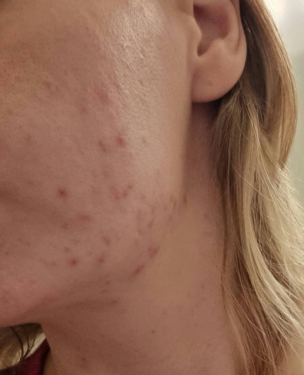 Before image for recHLG7MefJIIQNHY