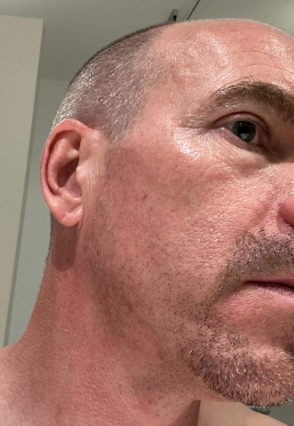 After image for recIewv3vnIcVilJ9