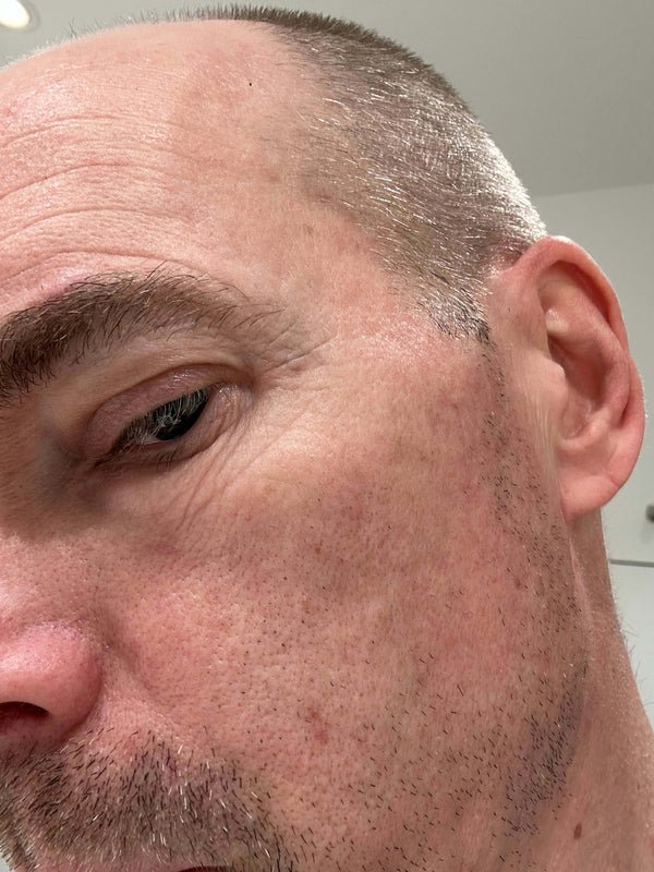 Before image for recIewv3vnIcVilJ9