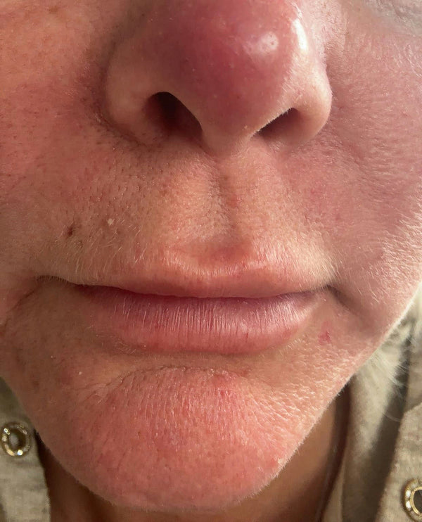 Before image for recJ0LAhsNToSULZd