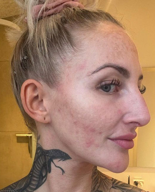 Before image for recJGERVb04rbhIMT