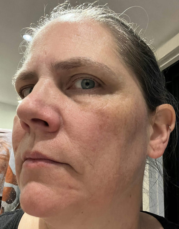 Before image for recJGopt9GsN6Z0ST