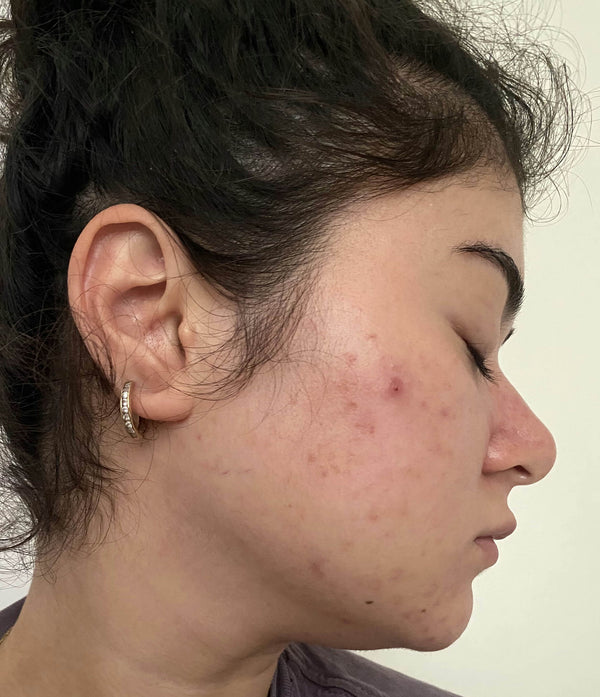 After image for recKKo7ooYR84tPvU