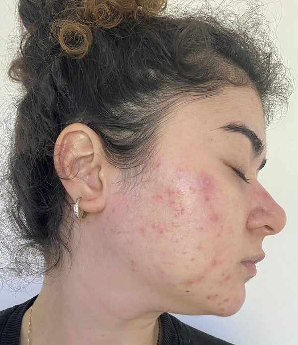 Before image for recKKo7ooYR84tPvU