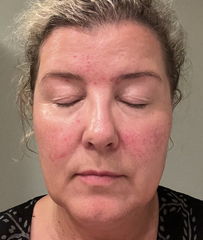 After image for recNvsexmSqksdq4D