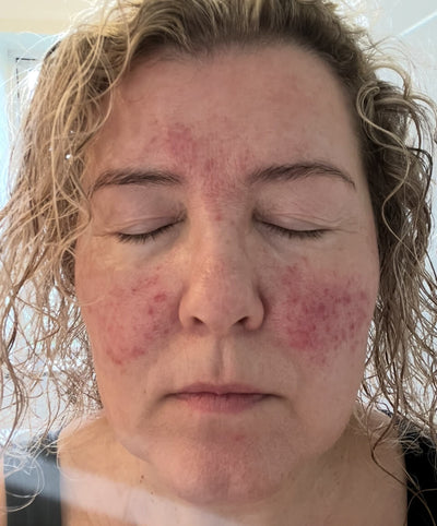 Before image for recNvsexmSqksdq4D