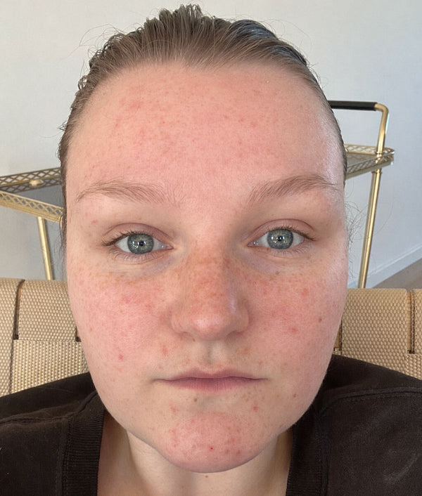 Before image for recOvW2analYyiHYF