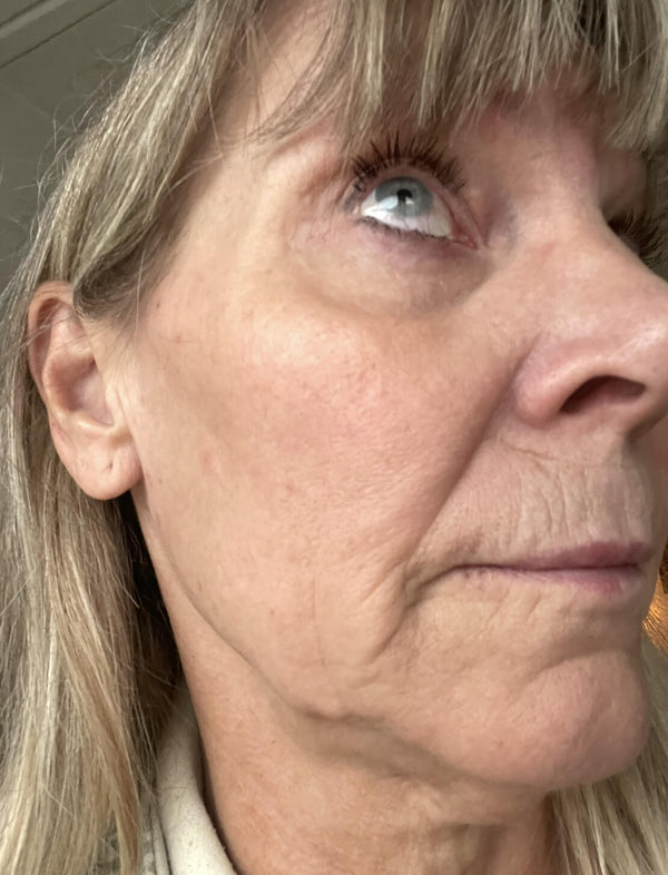 After image for recPrrZCT3Cf60MTp