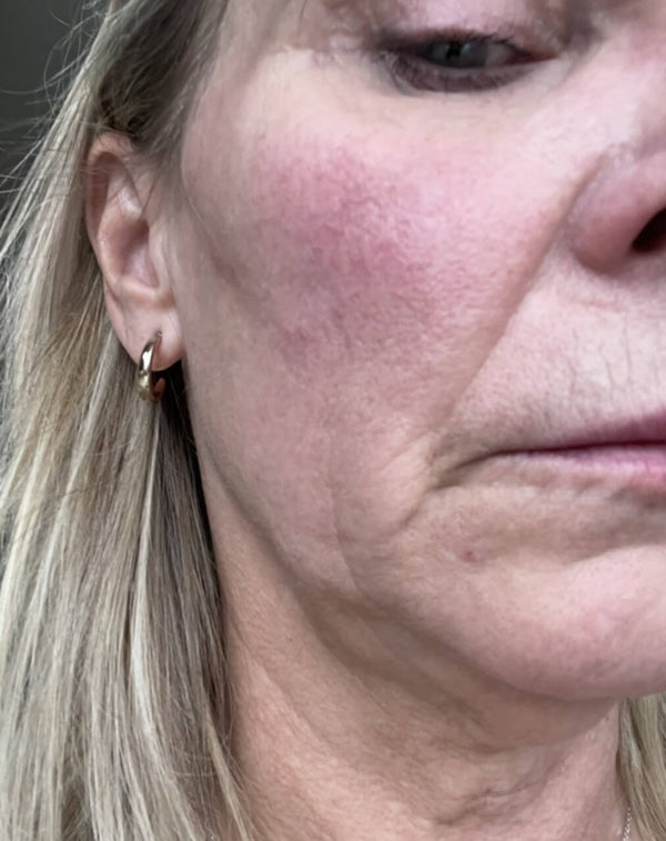 Before image for recPrrZCT3Cf60MTp