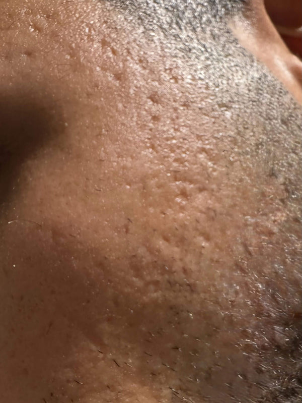 After image for recQqS1muUopAZydC